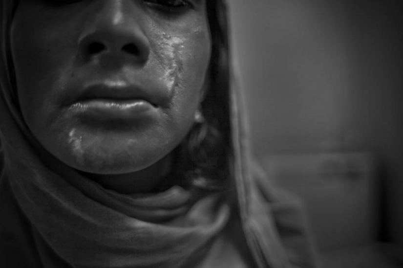 La educación de ácido en Bangladesh La educación de ácido en Bangladesh