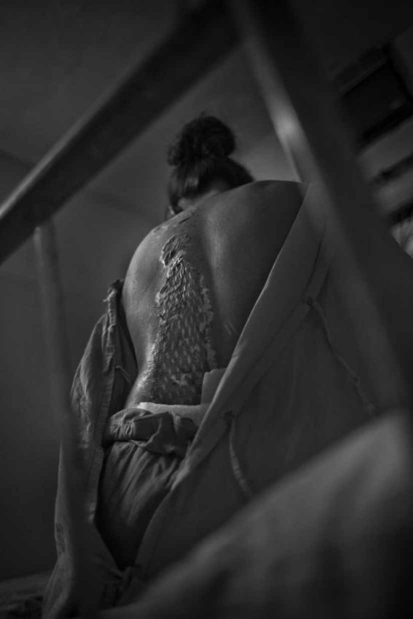 The education of acid in Bangladesh The education of acid in Bangladesh