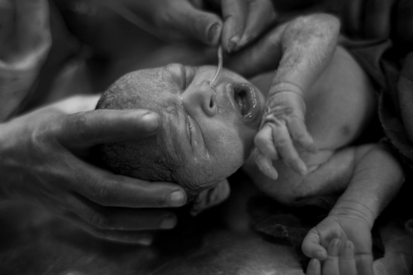 The education of acid in Bangladesh The education of acid in Bangladesh