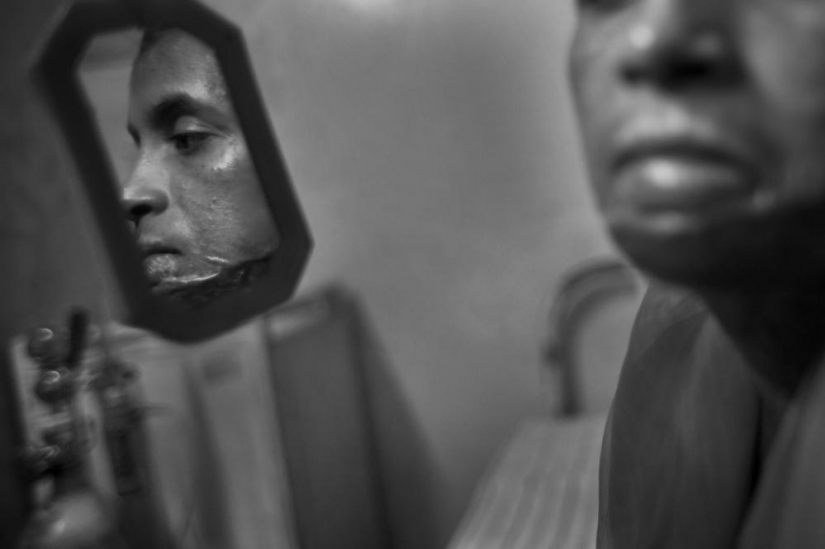 The education of acid in Bangladesh The education of acid in Bangladesh