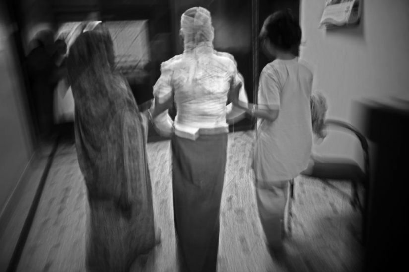 The education of acid in Bangladesh The education of acid in Bangladesh