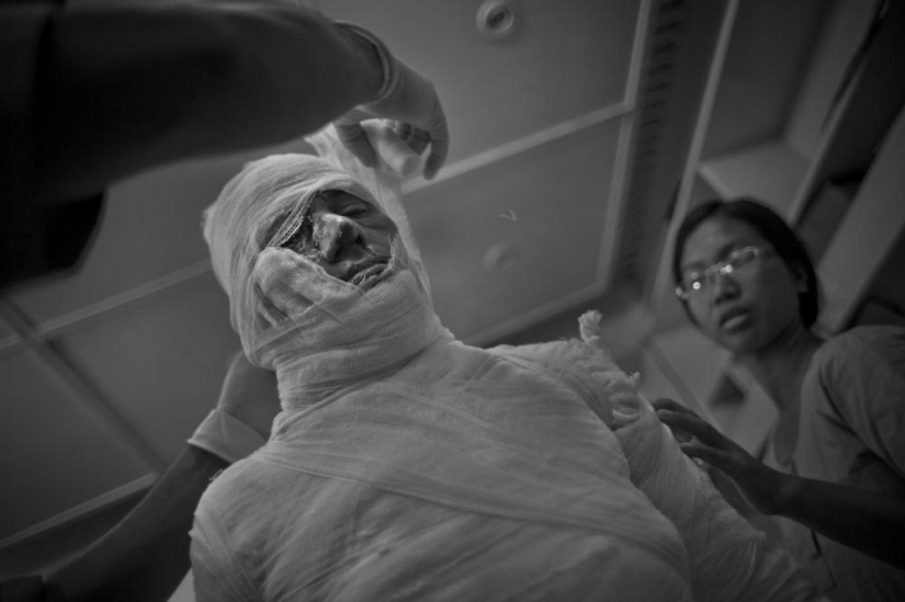 The education of acid in Bangladesh The education of acid in Bangladesh