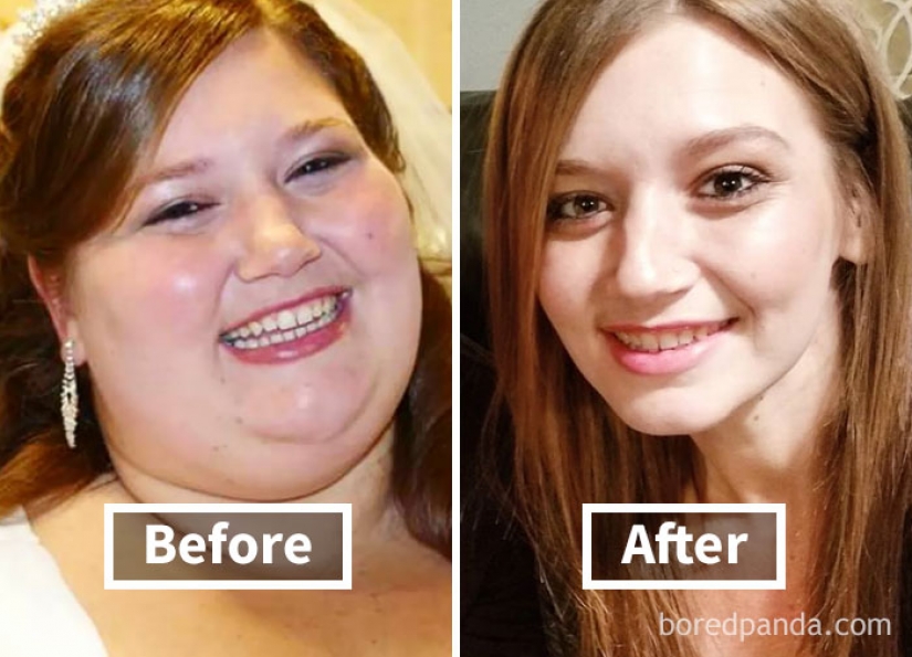 32 inspiring examples of how weight loss transforms the face