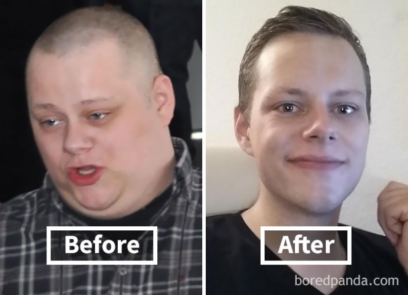 32 inspiring examples of how weight loss transforms the face