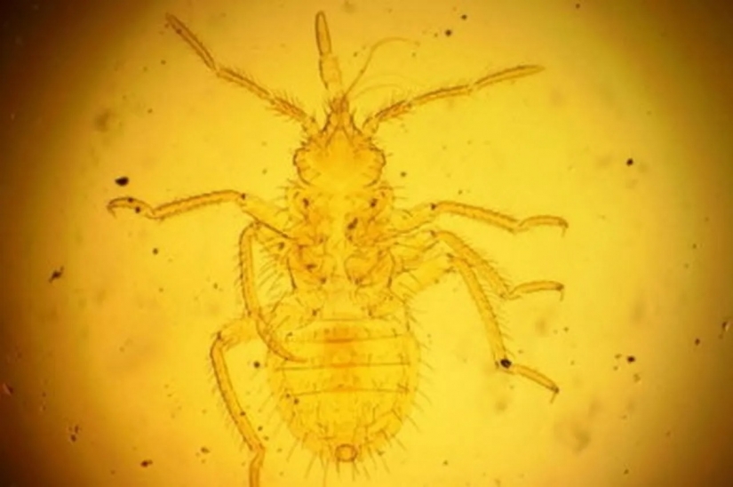 10 extraña pero fascinante problemas de la gente antigua 10 extraña pero fascinante problemas de la gente antigua