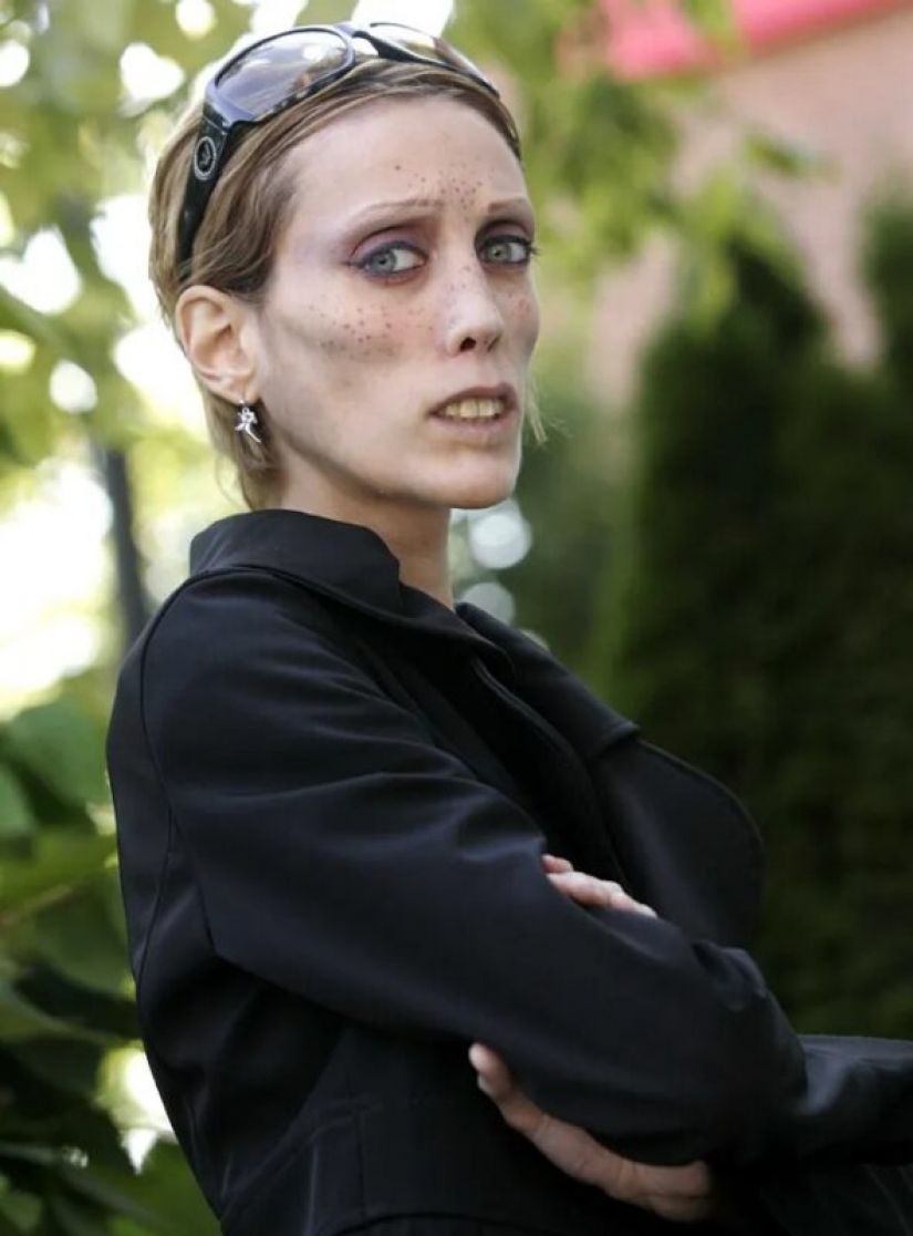 10 famosas chicas que la delgadez era digno de vivir