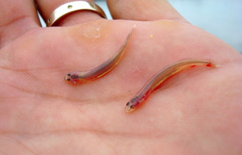10 most terrifying parasites that can live in the human body