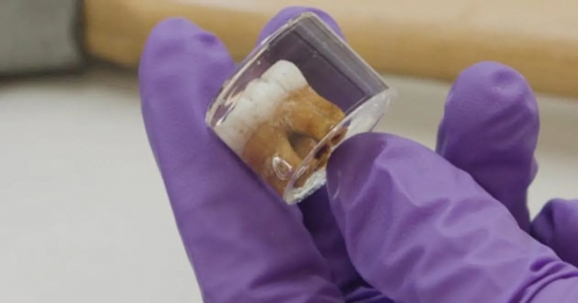 10 weird but fascinating problems of ancient people 10 weird but fascinating problems of ancient people