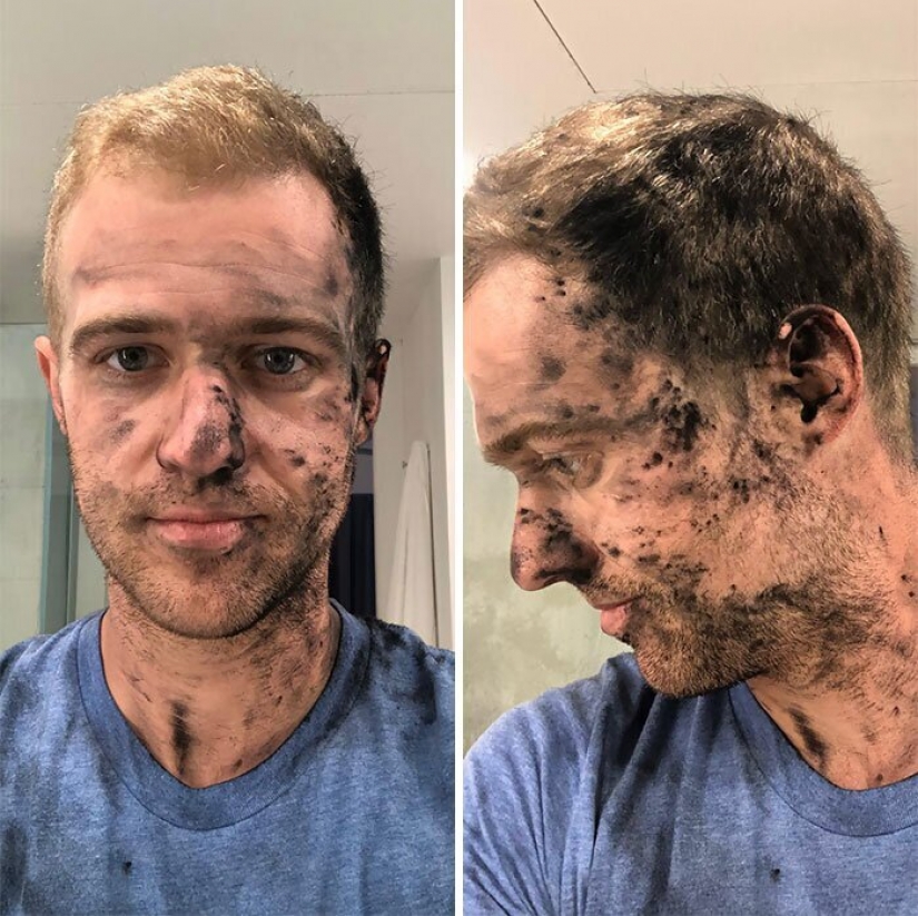 30 persons who are quarantined are given worse than you