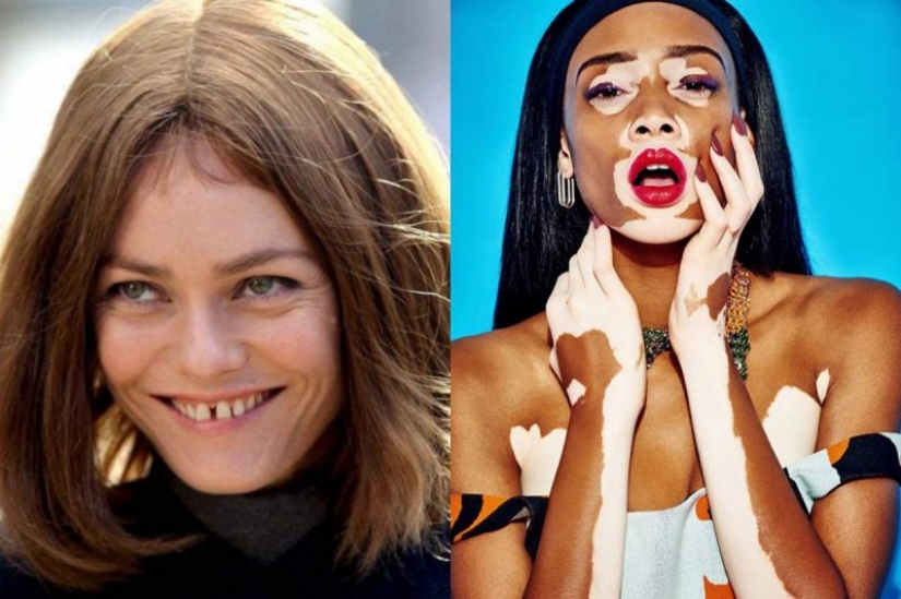 5 celebridades que nos encanta, a pesar de los defectos, en su apariencia 5 celebridades que nos encanta, a pesar de los defectos, en su apariencia