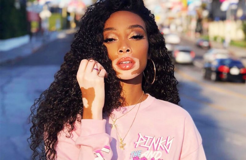 5 celebrities that we love, despite the defects in their appearance