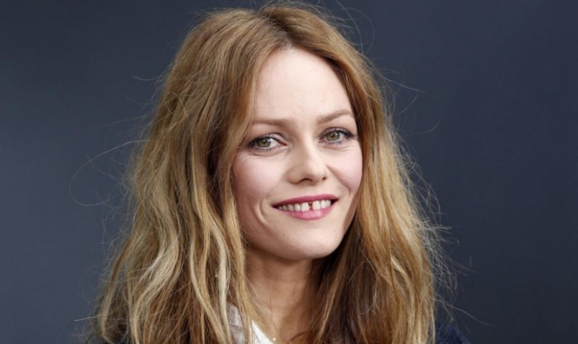 5 celebrities that we love, despite the defects in their appearance