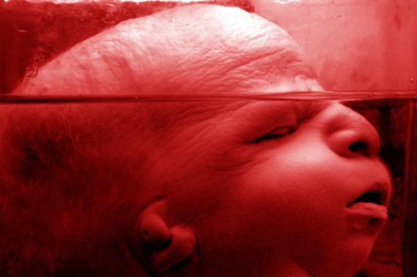 6 most shocking anatomical museums in the world 6 most shocking anatomical museums in the world