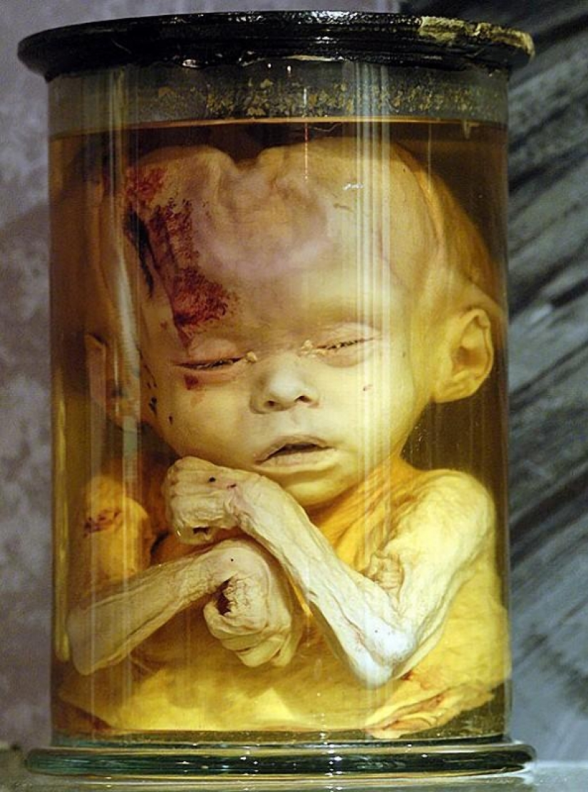6 most shocking anatomical museums in the world 6 most shocking anatomical museums in the world