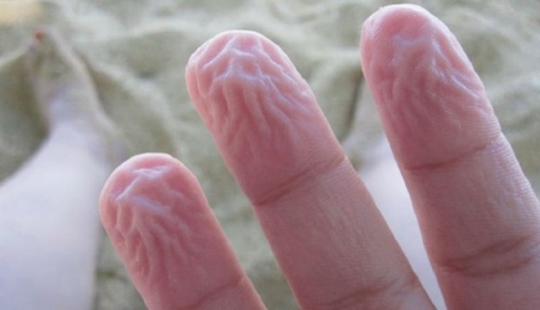 9 cosas extrañas que son los mecanismos de protección en nuestro cuerpo