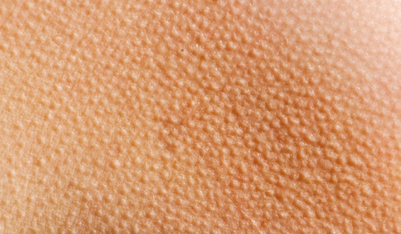 9 cosas extrañas que son los mecanismos de protección en nuestro cuerpo 9 cosas extrañas que son los mecanismos de protección en nuestro cuerpo