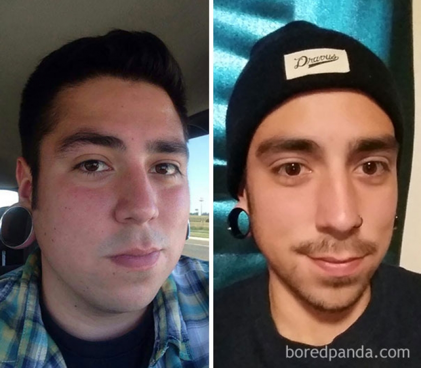 Antes y después: cómo cambiar la apariencia de la persona que deja de beber