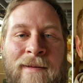 Antes y después: cómo cambiar la apariencia de la persona que deja de beber Antes y después: cómo cambiar la apariencia de la persona que deja de beber