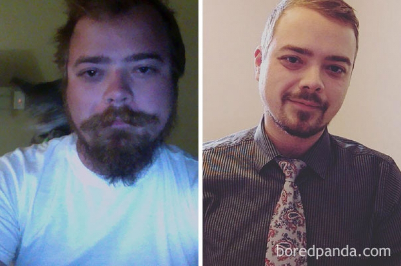 Antes y después: cómo cambiar la apariencia de la persona que deja de beber