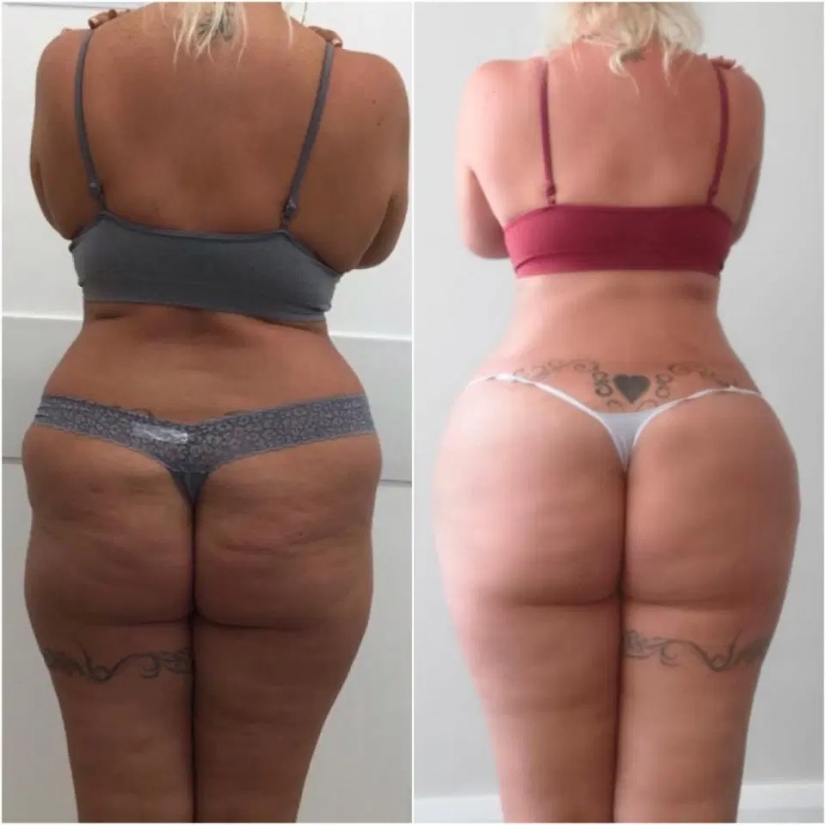 Ass for tip-top: the Briton made a butt lift to hang out with her daughter to bars