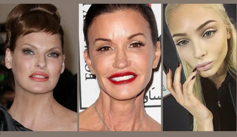 Beauty in the past: models who ruined her looks with plastic Beauty in the past: models who ruined her looks with plastic