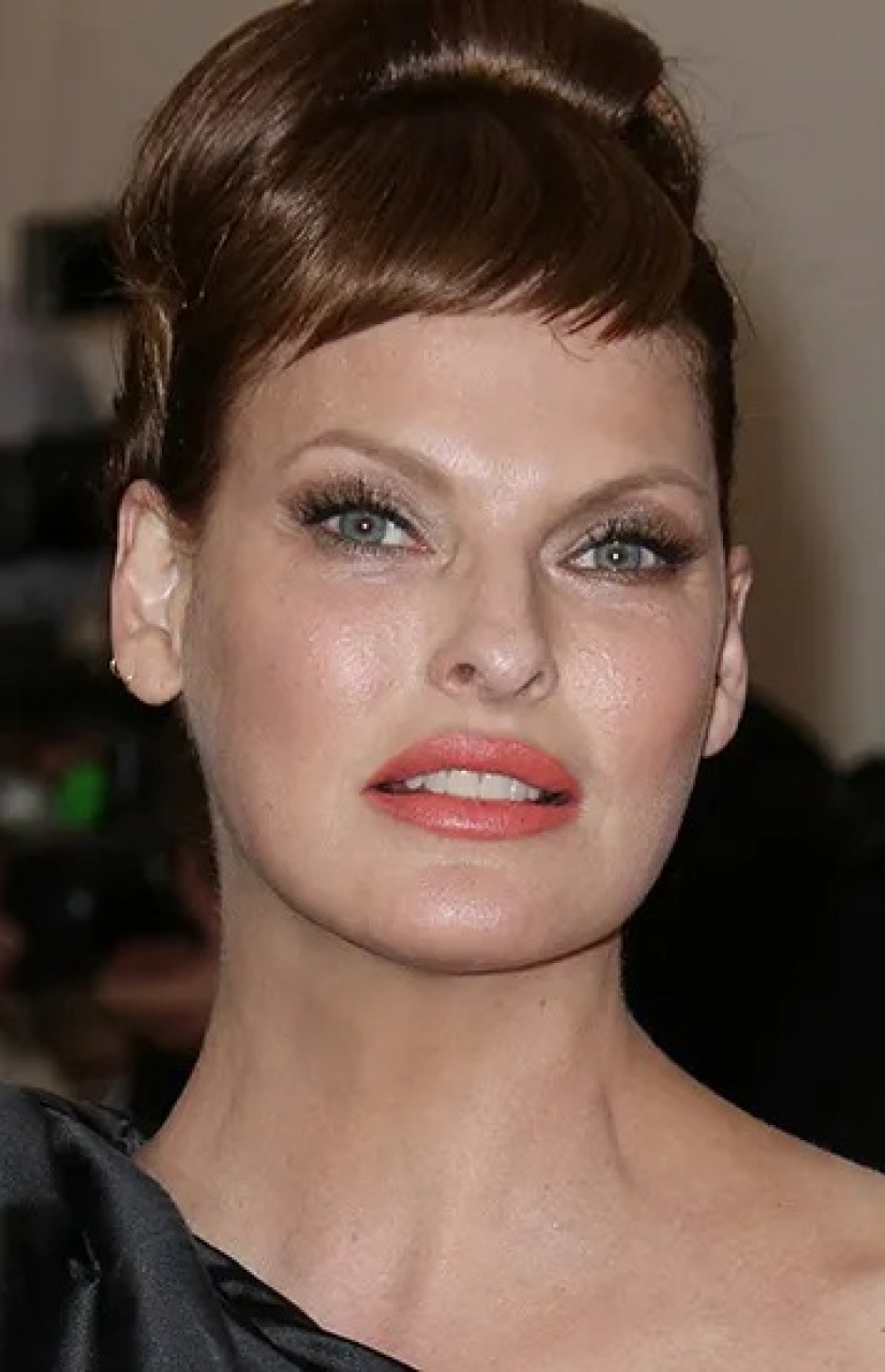 Beauty in the past: models who ruined her looks with plastic Beauty in the past: models who ruined her looks with plastic