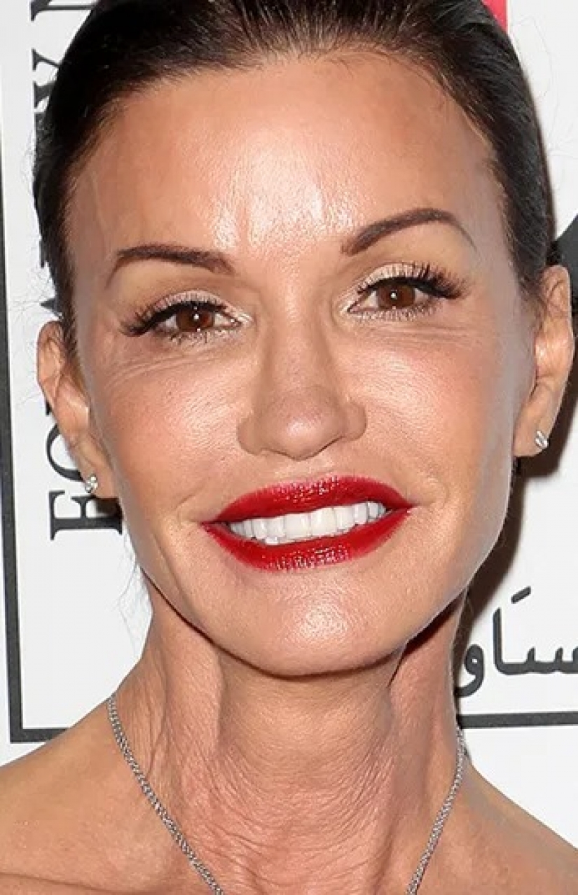 Beauty in the past: models who ruined her looks with plastic Beauty in the past: models who ruined her looks with plastic