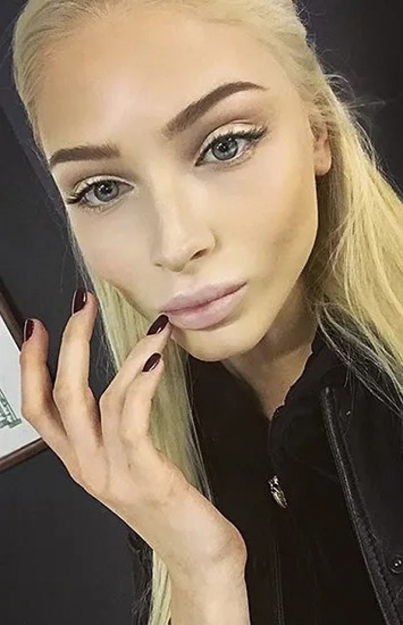 Beauty in the past: models who ruined her looks with plastic Beauty in the past: models who ruined her looks with plastic