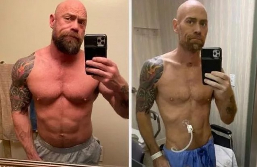 Bodybuilder gay ill with the coronavirus and in 6 weeks lost 23 kg Bodybuilder gay ill with the coronavirus and in 6 weeks lost 23 kg