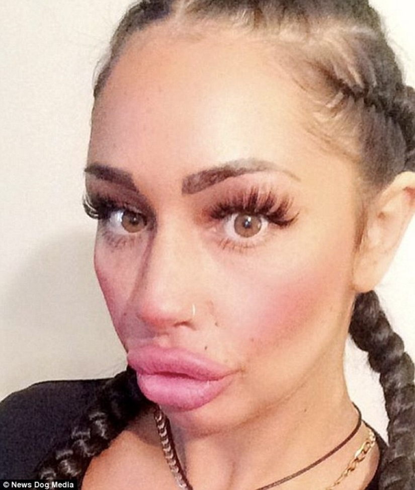 British albóndigas: una madre soltera de Liverpool ha pasado casi 2 mil libras para un intercambio de los labios y no puede parar British albóndigas: una madre soltera de Liverpool ha pasado casi 2 mil libras para un intercambio de los labios y no puede parar