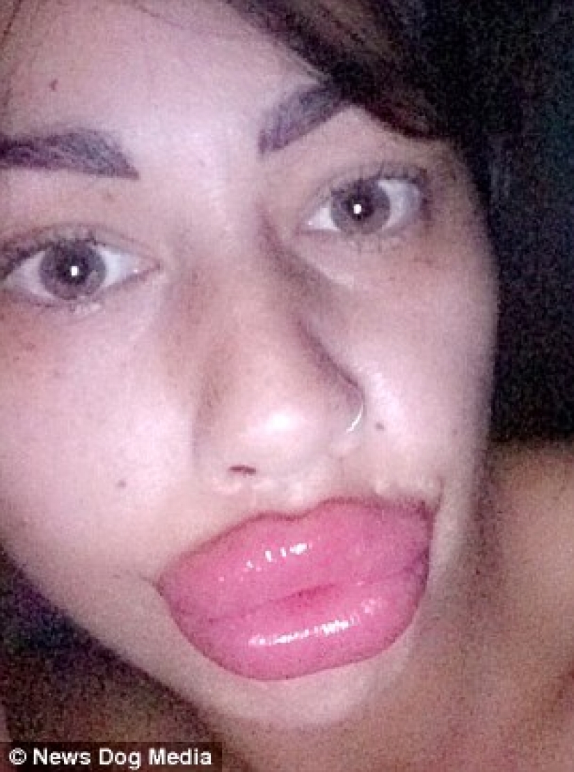 British albóndigas: una madre soltera de Liverpool ha pasado casi 2 mil libras para un intercambio de los labios y no puede parar British albóndigas: una madre soltera de Liverpool ha pasado casi 2 mil libras para un intercambio de los labios y no puede parar