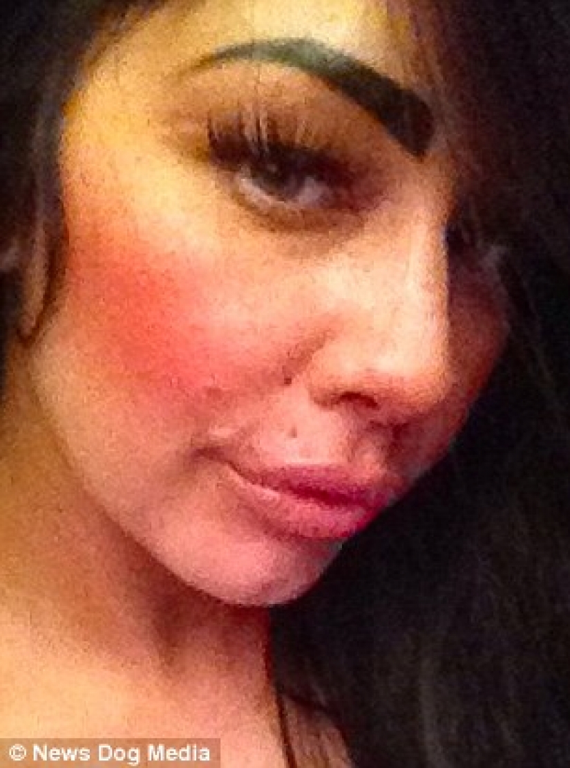 British albóndigas: una madre soltera de Liverpool ha pasado casi 2 mil libras para un intercambio de los labios y no puede parar British albóndigas: una madre soltera de Liverpool ha pasado casi 2 mil libras para un intercambio de los labios y no puede parar