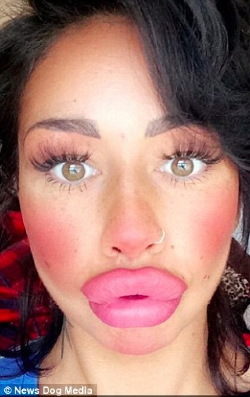 British albóndigas: una madre soltera de Liverpool ha pasado casi 2 mil libras para un intercambio de los labios y no puede parar British albóndigas: una madre soltera de Liverpool ha pasado casi 2 mil libras para un intercambio de los labios y no puede parar