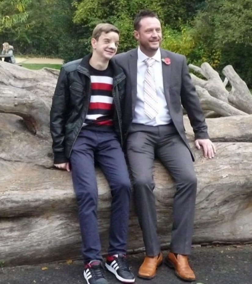 British soldiers raised money for an operation for a boy from Bosnia, who was born with a rare defect on the face