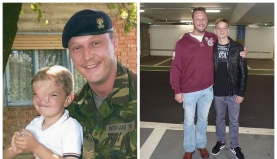 British soldiers raised money for an operation for a boy from Bosnia, who was born with a rare defect on the face British soldiers raised money for an operation for a boy from Bosnia, who was born with a rare defect on the face