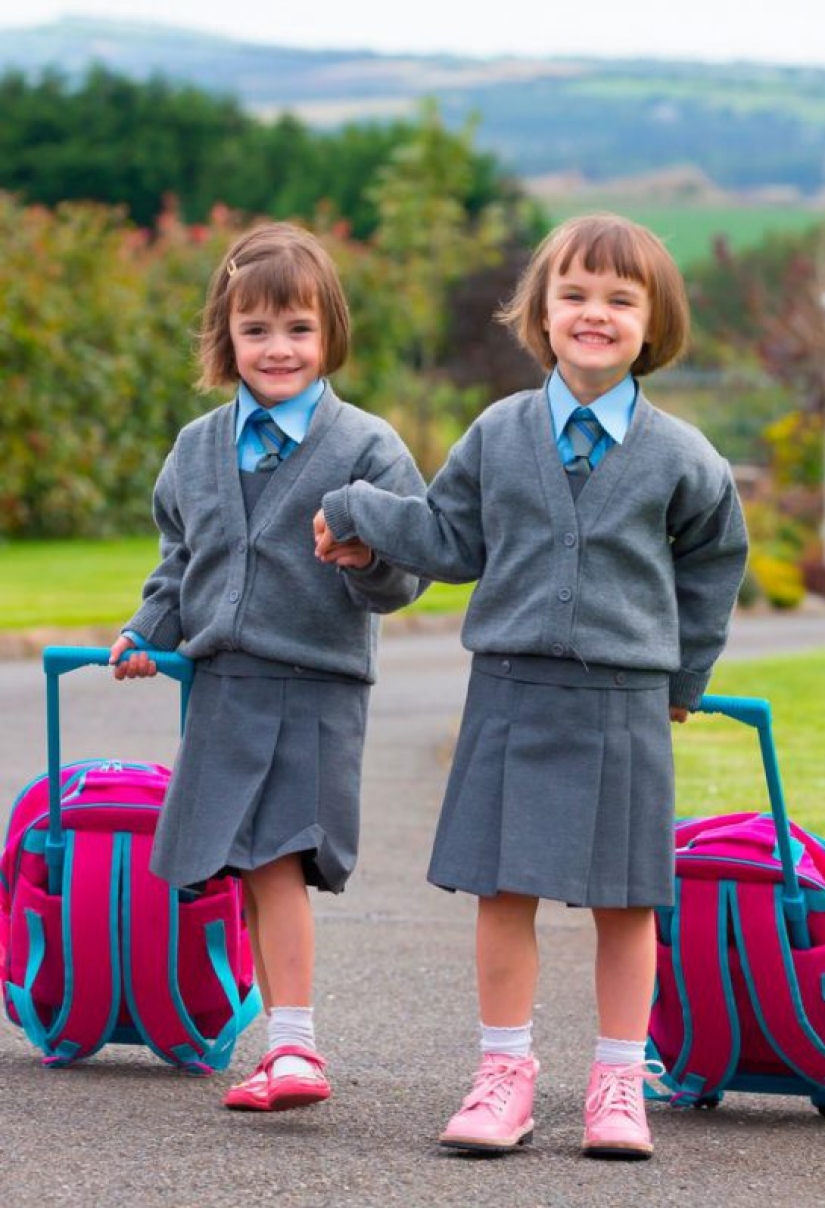 Connected by a single destiny: the miracle twins who were born with a break of 87 days Connected by a single destiny: the miracle twins who were born with a break of 87 days