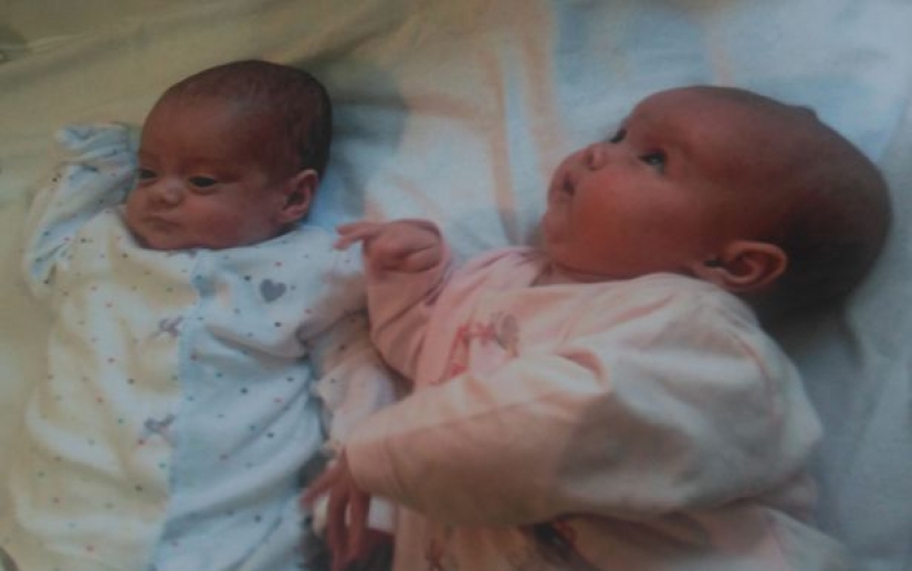 Connected by a single destiny: the miracle twins who were born with a break of 87 days Connected by a single destiny: the miracle twins who were born with a break of 87 days