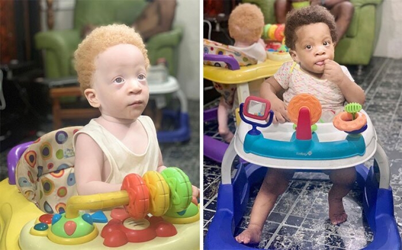 ¿Cuál es el secreto de los gemelos, con diferentes colores de piel, de Nigeria ¿Cuál es el secreto de los gemelos, con diferentes colores de piel, de Nigeria