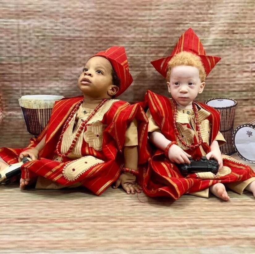 ¿Cuál es el secreto de los gemelos, con diferentes colores de piel, de Nigeria ¿Cuál es el secreto de los gemelos, con diferentes colores de piel, de Nigeria