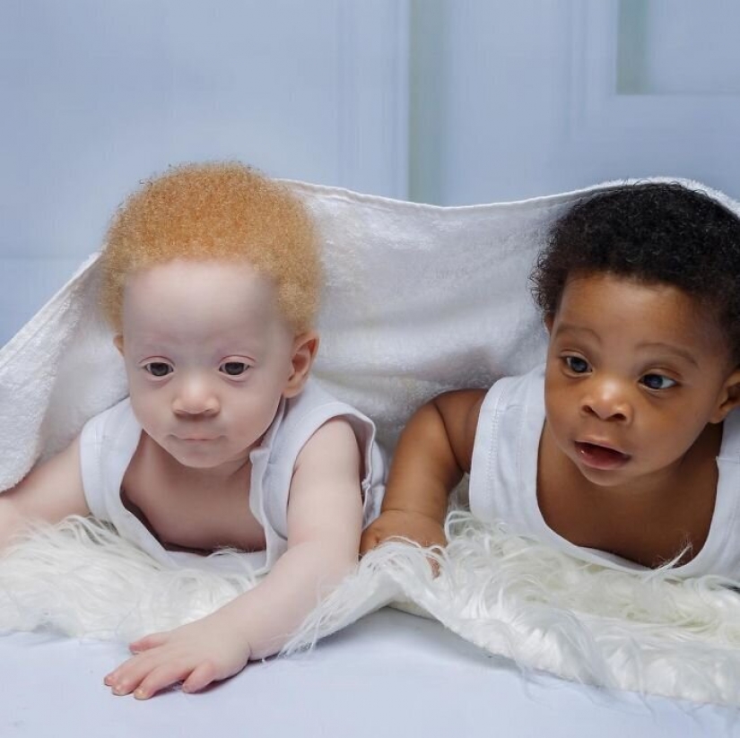 ¿Cuál es el secreto de los gemelos, con diferentes colores de piel, de Nigeria ¿Cuál es el secreto de los gemelos, con diferentes colores de piel, de Nigeria