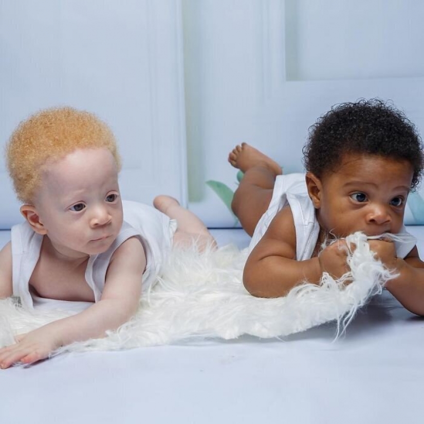 ¿Cuál es el secreto de los gemelos, con diferentes colores de piel, de Nigeria ¿Cuál es el secreto de los gemelos, con diferentes colores de piel, de Nigeria