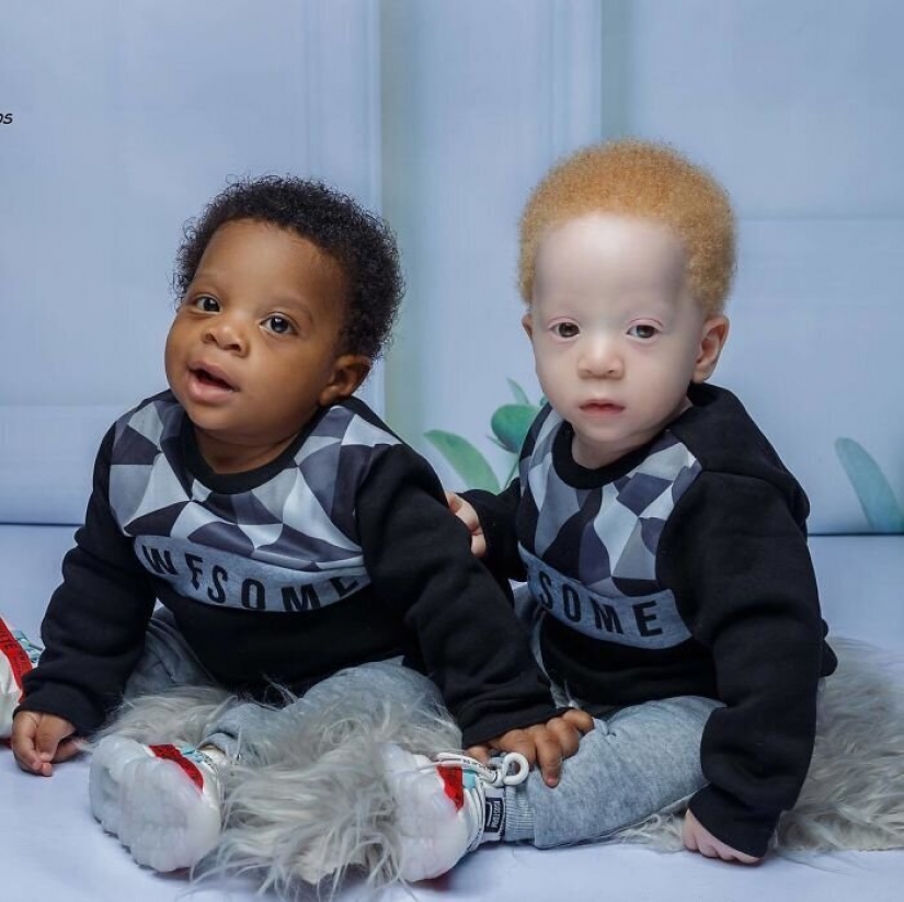 ¿Cuál es el secreto de los gemelos, con diferentes colores de piel, de Nigeria ¿Cuál es el secreto de los gemelos, con diferentes colores de piel, de Nigeria