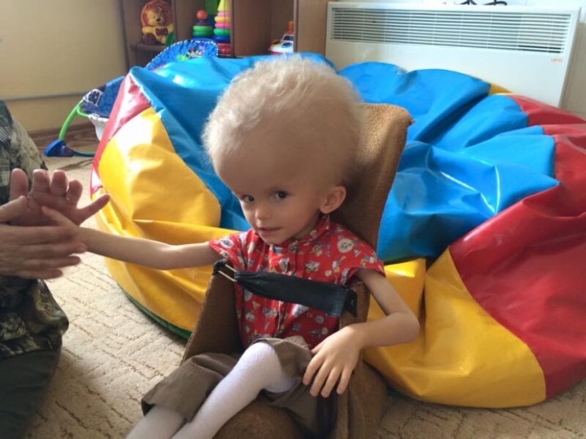 De un niño con una inusual de la cabeza resultó ser padres, pero el destino le dio una nueva familia De un niño con una inusual de la cabeza resultó ser padres, pero el destino le dio una nueva familia