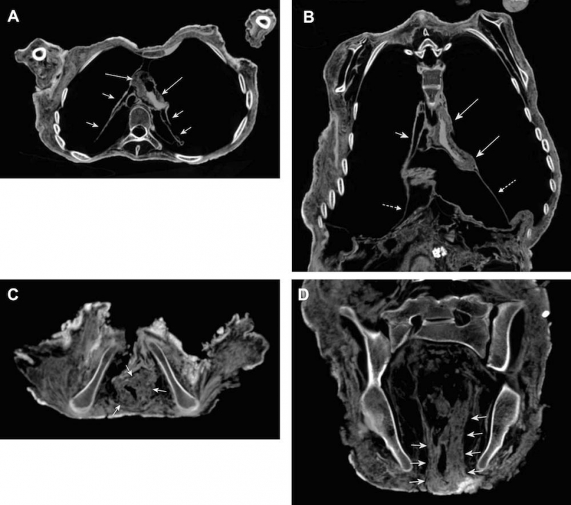 El Inca momias de sacrificar niños y mujeres