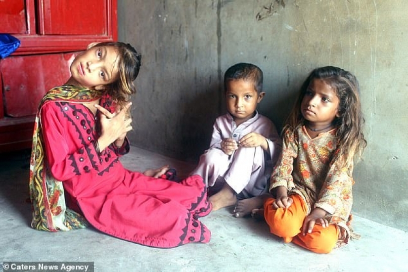 El mundo está en un ángulo recto: cuello de 11 años Pakistaní girado 90 grados El mundo está en un ángulo recto: cuello de 11 años Pakistaní girado 90 grados