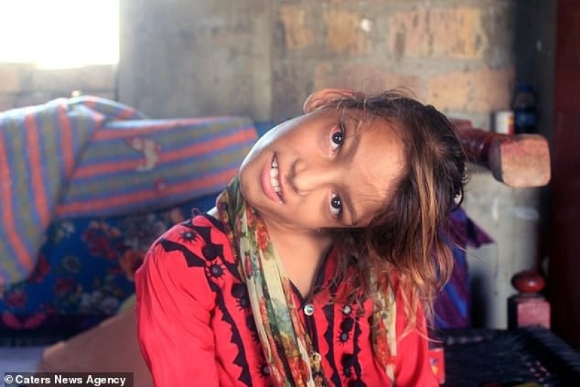 El mundo está en un ángulo recto: cuello de 11 años Pakistaní girado 90 grados El mundo está en un ángulo recto: cuello de 11 años Pakistaní girado 90 grados