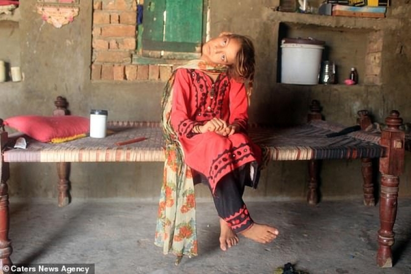 El mundo está en un ángulo recto: cuello de 11 años Pakistaní girado 90 grados El mundo está en un ángulo recto: cuello de 11 años Pakistaní girado 90 grados