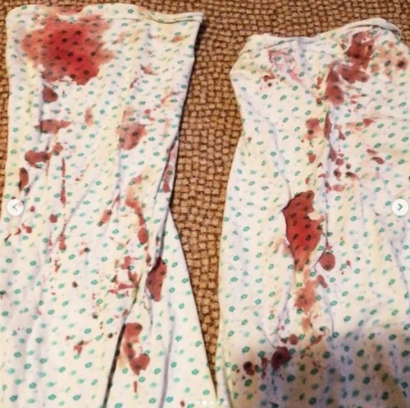 Ella se curó de la psoriasis, gracias al milagro de la dieta, y ahora su método ayuda a miles
