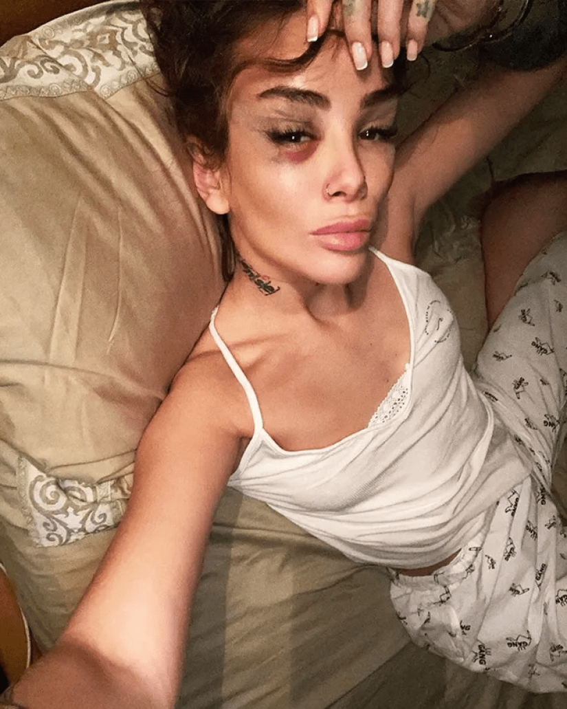 Ellos no son de hierro! La estrella, que la cuarentena ha llevado a un colapso nervioso