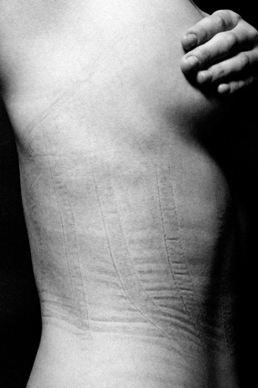 Esto es lo que está detrás de la hembra esplendor. En estas fotos aún es doloroso ver